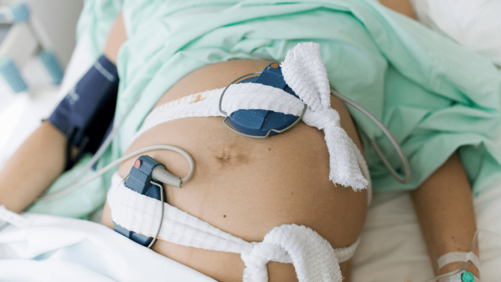 pregnant woman on ctg for monitoring during induction of labour by syntocinon infusion
